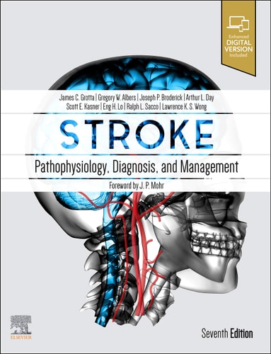 Stroke Pathophysiology, Diagnosis, and Management cover