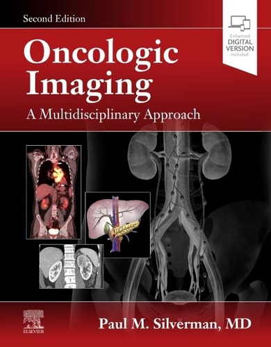 Oncologic Imaging A Multidisciplinary Approach cover
