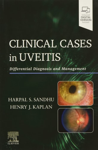 Clinical Cases in Uveitis Differential Diagnosis and Management cover