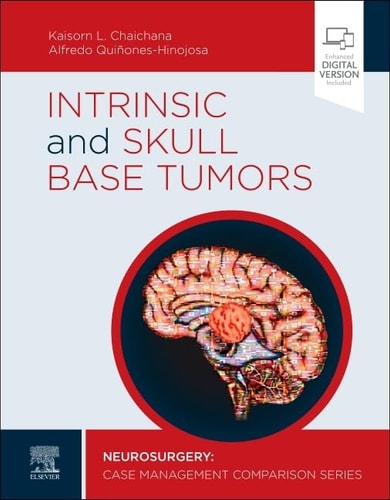 Intrinsic and Skull Base Tumors Neurosurgery: Case Management Comparison Series cover
