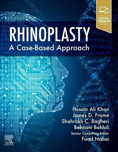 Rhinoplasty A Case-Based Approach cover