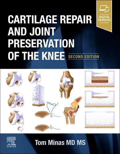 Cartilage Repair and Joint Preservation of the Knee cover