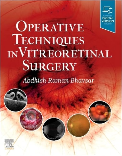 Operative Techniques in Vitreoretinal Surgery cover