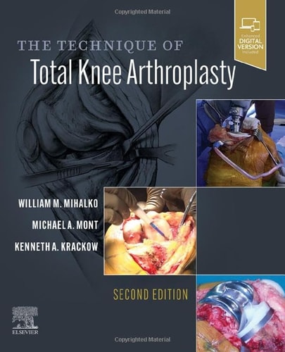 The Technique of Total Knee Arthroplasty cover