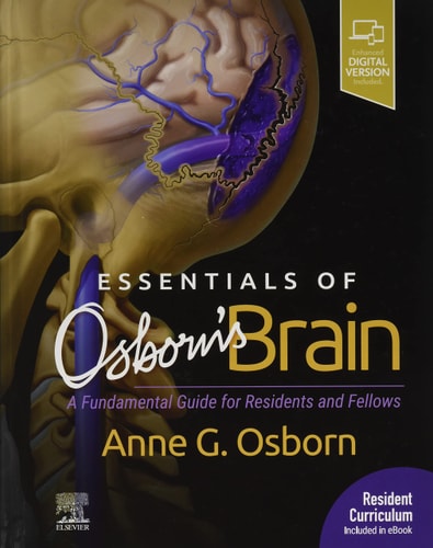 Essentials of Osborn's Brain A Fundamental Guide for Residents and Fellows cover