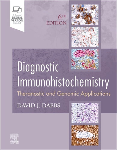 Diagnostic Immunohistochemistry Theranostic and Genomic Applications cover