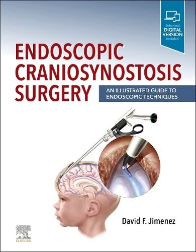 Endoscopic Craniosynostosis Surgery An Illustrated Guide to Endoscopic Techniques cover