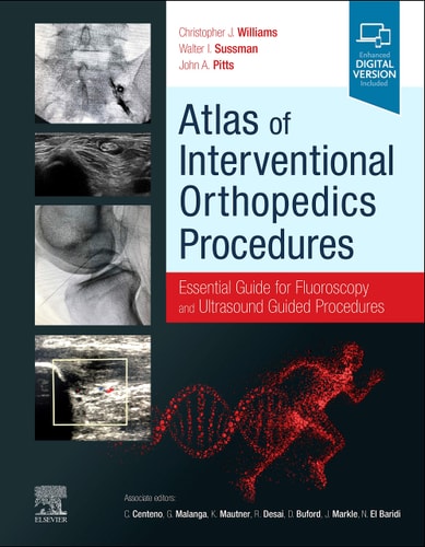 Atlas of Interventional Orthopedics Procedures Essential Guide for Fluoroscopy and Ultrasound Guided Procedures cover