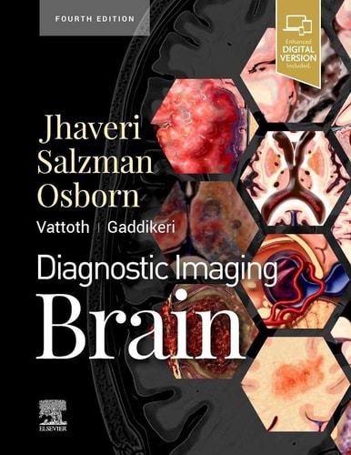 Diagnostic Imaging: Brain cover
