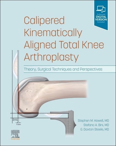 KINEMATIC KNEE ALIGNMENT Theory, Surgical Techniques and Perspectives cover
