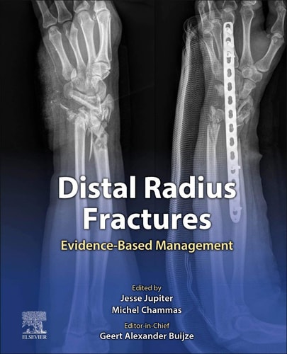 Distal Radius Fractures Evidence-Based Management cover