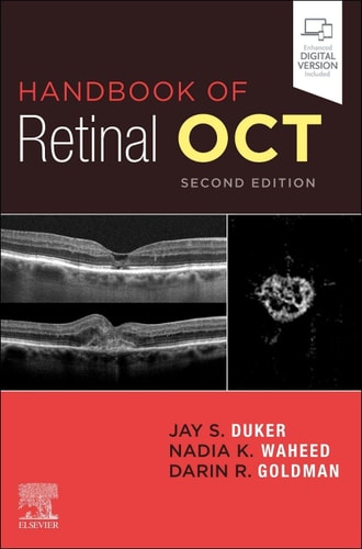 Handbook of Retinal OCT: Optical Coherence Tomography cover