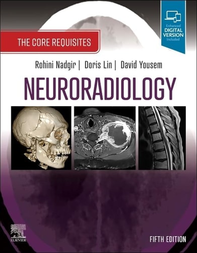 Neuroradiology The Core Requisites cover