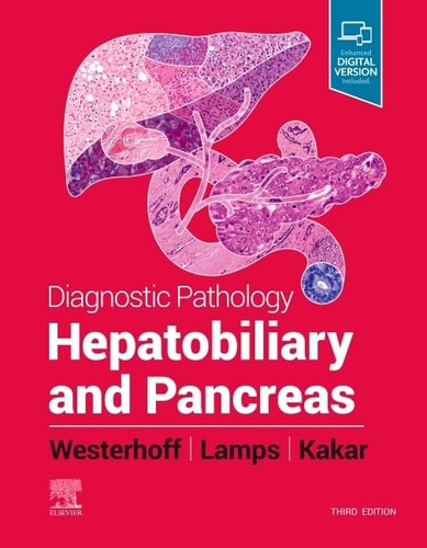 Diagnostic Pathology : Hepatobiliary and Pancreas cover