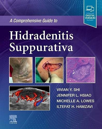 A Comprehensive Guide to Hidradenitis Suppurativa cover