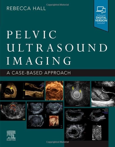 Pelvic Ultrasound Imaging A Cased-Based Approach cover