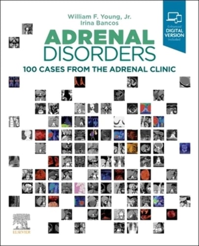 Adrenal Disorders 100 Cases from the Adrenal Clinic cover