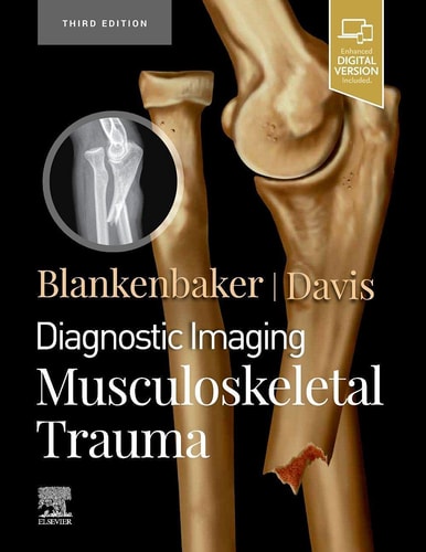 Diagnostic Imaging: Musculoskeletal Trauma cover