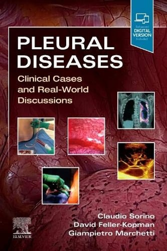Pleural Diseases Clinical Cases and Real-World Discussions cover