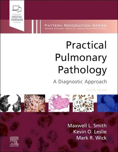 Practical Pulmonary Pathology A Diagnostic Approach cover
