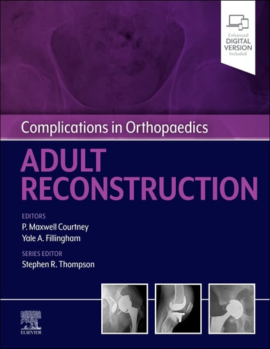 Complications in Orthopaedics: Adult Reconstruction cover