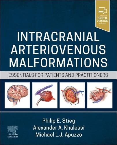 Intracranial Arteriovenous Malformations Essentials for Patients and Practitioners cover
