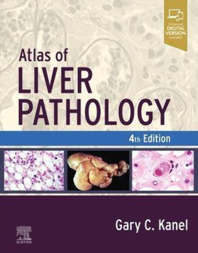 Atlas of Liver Pathology cover