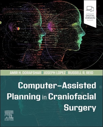 Computer-Assisted Planning in Craniofacial Surgery cover