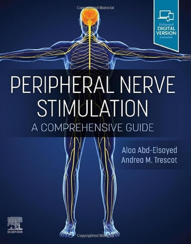 Peripheral Nerve Stimulation A Comprehensive Guide cover