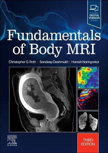 Fundamentals of Body MRI cover