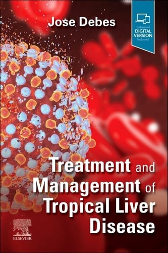 Treatment and Management of Tropical Liver Disease cover