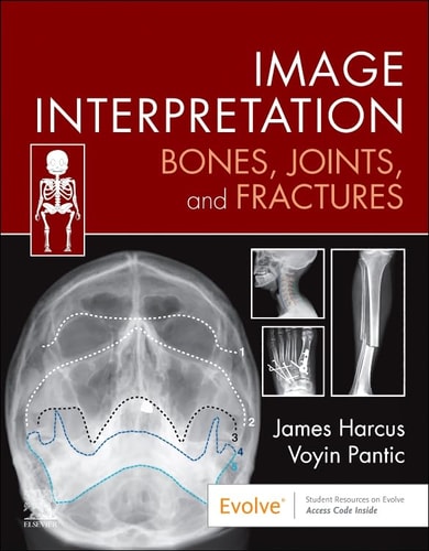 Image Interpretation: Bones, Joints, and Fractures cover