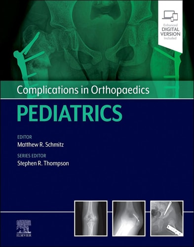 Complications in Orthopaedics: Pediatrics cover