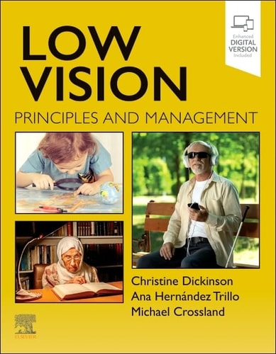 Low Vision Principles and Management cover