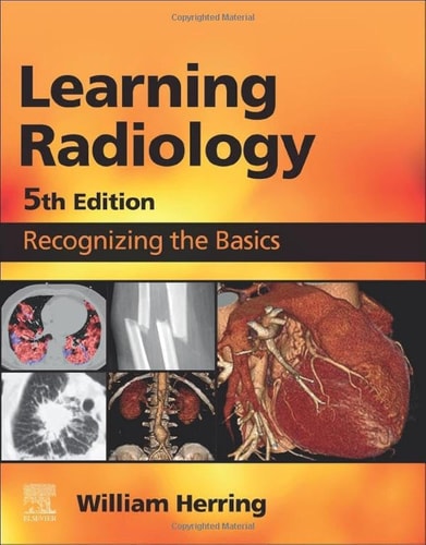 Learning Radiology Recognizing the Basics cover