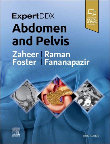 ExpertDDx: Abdomen and Pelvis cover
