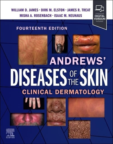 Andrews' Diseases of the Skin Clinical Dermatology cover