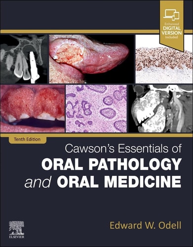 Cawson's Essentials of Oral Pathology and Oral Medicine cover