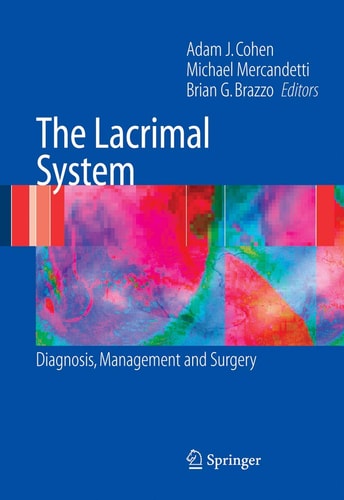The Lacrimal System Diagnosis, Management and Surgery cover