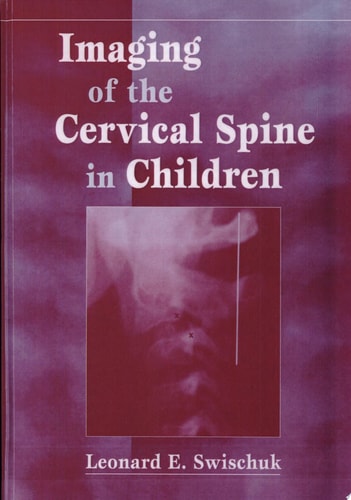 Imaging of the Cervical Spine in Children cover