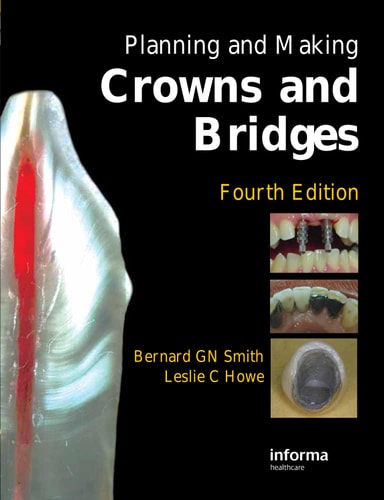 Planning and Making Crowns and Bridges cover