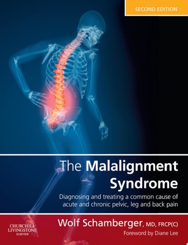 The Malalignment Syndrome diagnosis and treatment of common pelvic and back pain cover