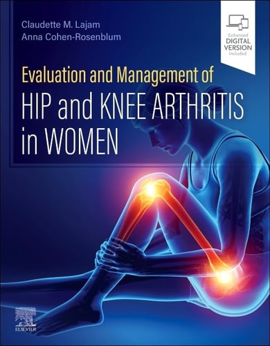 Evaluation and Management of Hip and Knee Arthritis in Women cover