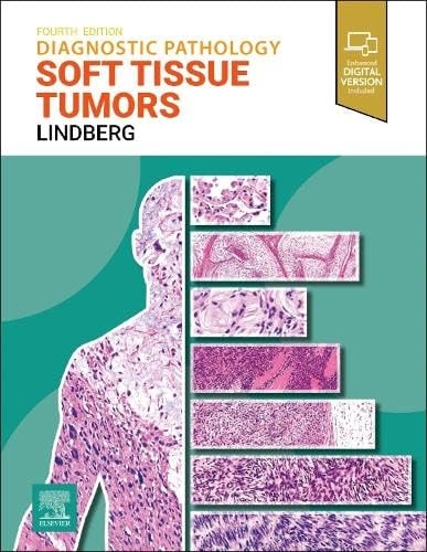 Diagnostic Pathology: Soft Tissue Tumors cover