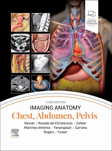 Imaging Anatomy: Chest, Abdomen, Pelvis cover
