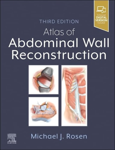 Atlas of Abdominal Wall Reconstruction cover