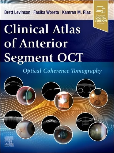 Clinical Atlas of Anterior Segment OCT: Optical Coherence Tomography cover