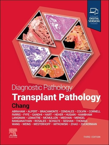Diagnostic Pathology: Transplant Pathology cover