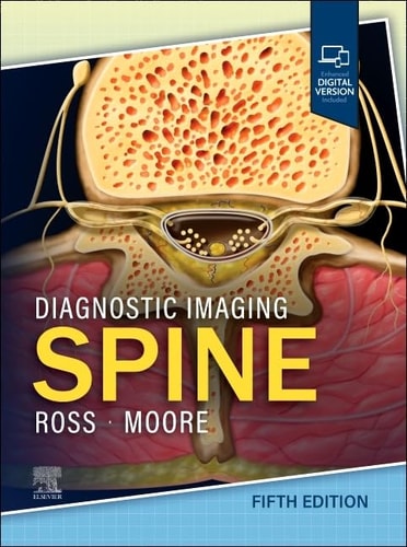 Diagnostic Imaging: Spine cover