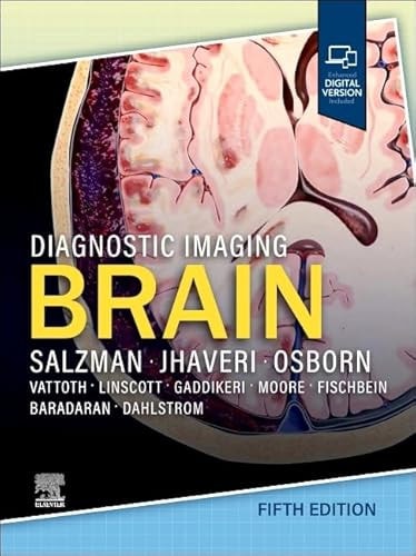 Diagnostic Imaging: Brain cover
